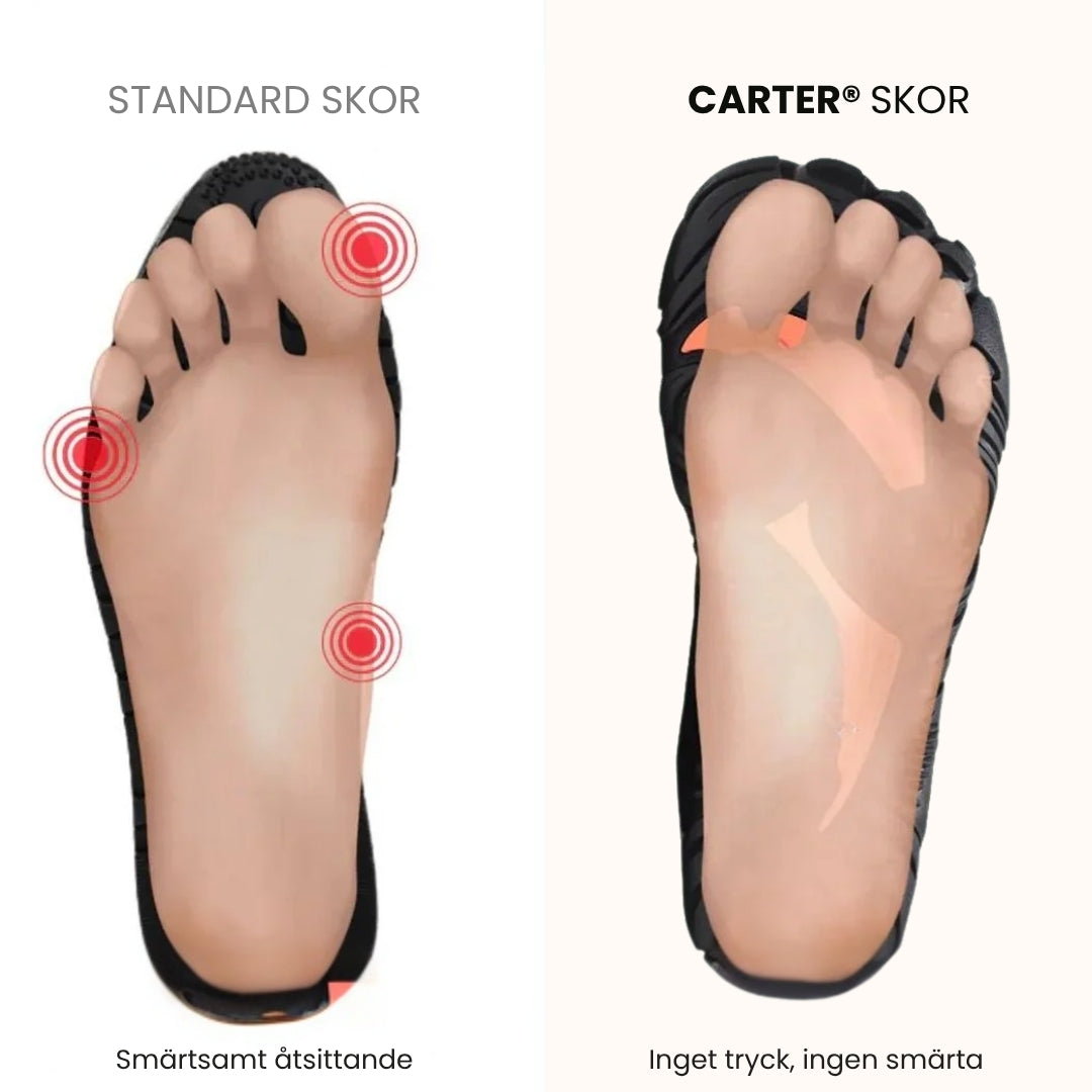 Carter®